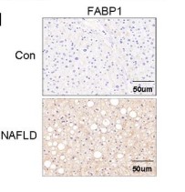 Immunohistochemistry for FABP1 in the liver.jpg